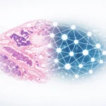 Deep Learning for Ovarian Cancer Subtype Prediction