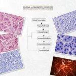 TNBC Surrogate Subtype Classification Using IHC